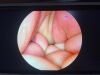 CONMED IM8000 camera console with IM8123 urology  camera head Laparoscope