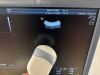 GE Voluson E6 Ultrasound - OB / GYN - Vascular