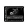 SONOME H5C10L SonoMe H5C10L Wireless Handheld Ultrasound Probe Portable Convex & Linear Scanner for Medical Imaging & Point-of-Care Diagnosis