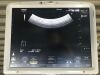 HITACHI Noblus Ultrasound - OB / GYN - Vascular