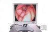 STRYKER Arthroscopic Kit (SV-2, L9000, 1088i HD, FLUID SAFE) with  HD Camera Head (1088-210-122) Arthroscope