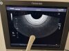 TOSHIBA Xario Prime Ultrasound - Shared Service