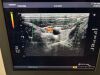 TOSHIBA Xario Prime Ultrasound - Shared Service