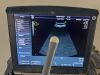 GE Voluson I Ultrasound - Shared Service