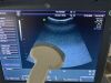 GE Voluson I Ultrasound - Shared Service