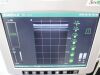 BARD Site Rite 6 with L-VA Probe 9770001, Power Supply 9770065, Cart, Keyboard, Printer TESTED Ultrasound - Cardiac - Vascular
