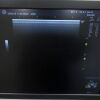 GE LOGIQ P9 Ultrasound - OB / GYN