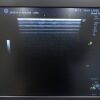 GE LOGIQ P9 Ultrasound - OB / GYN