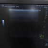 GE LOGIQ P9 Ultrasound - OB / GYN