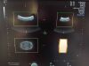GE RAB6D Ultrasound Transducer