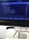 GE Vivid S6 Ultrasound - Cardiac