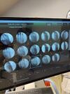 HOLOGIC InSight2 C-Arm