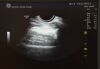 GE RIC5-9-D Wide Band Convex Array Endocavitary 4D Volume Ultrasound Transducer H48651MS - 202332 Ultrasound Transducer