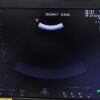 GE VOLUSON S8 Ultrasound - OB / GYN