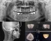 HDX DENTRI-S Dental X-Ray
