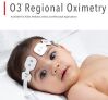 MASIMO MOC-9 O3 Regional SPO2 Probe
