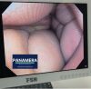 OLYMPUS CF-Q180AL Colonoscope