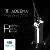 ADEENA RF CO2 Laser multi-functional platform machine for Skin Rejuvenation,vaginal Tightening HighPower Machine with From USA Laser - Co2