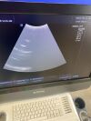 ALPINION E-CUBE 5 Ultrasound System