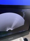 ALPINION E-CUBE 5 Ultrasound System