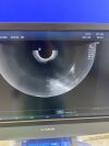 ALPINION E-CUBE 12 Ultrasound System