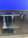 ALPINION E-CUBE 12 Ultrasound System