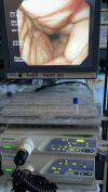 OLYMPUS CF-H260AI Colonoscope