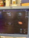 GE Ultrasound General Electrics GE Logiq E9