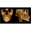 CARESTREAM CS9300 Premium Pan + CBCT (FOV 17x13.5) Dental X-Ray
