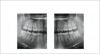 GENDEX GXDP-700 Pan Dental X-Ray