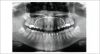 GENDEX GXDP-700 Pan Dental X-Ray