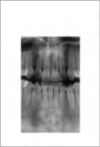 GENDEX GXDP-700 Pan Dental X-Ray