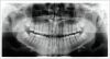GENDEX GXDP-700 Pan Dental X-Ray
