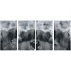 GENORAY Papaya Pan Dental X-Ray