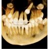 I-CAT FLX V17 2D+3D+CBCT Pan FOV 23x17 with PC, Warranty Dental X-Ray