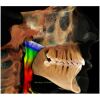 I-CAT FLX V17 2D+3D+CBCT Pan FOV 23x17 with PC, Warranty Dental X-Ray