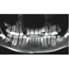 I-CAT FLX V17 2D+3D+CBCT Pan FOV 23x17 with PC, Warranty Dental X-Ray