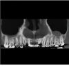I-CAT FLX V17 2D+3D+CBCT Pan FOV 23x17 with PC, Warranty Dental X-Ray