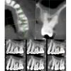 I-CAT FLX V17 2D+3D+CBCT Pan FOV 23x17 with PC, Warranty Dental X-Ray