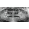 INSTRUMENTARIUM Orthopantomograph OP200 Pan Dental X-Ray