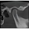 INSTRUMENTARIUM Orthopantomograph OP200 Pan Dental X-Ray