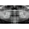 INSTRUMENTARIUM Orthopantomograph OP200 Pan Dental X-Ray