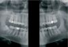 KAVO OP3D Pan Dental X-Ray