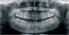 KAVO OP3D Pan Dental X-Ray