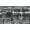 NEWTOM Giano HR Prime Pan + CBCT (FOV 10x8) Dental X-Ray