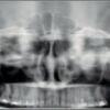 PLANMECA Proline Pan + Ceph Dental X-Ray