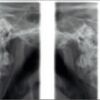 PLANMECA Proline Pan + Ceph Dental X-Ray