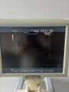 MEDISON SONOACE X6 Ultrasound - OB / GYN - Vascular