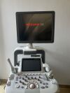 MEDISON ACCUVIX XG