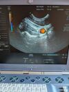 GE Voluson i Ultrasound - OB / GYN
